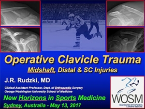 Clavicle Fractures 2017 – Sydney, NSW Australia